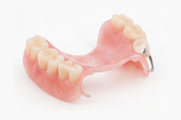 4-frameprothese-gedeeltelijke-prothese-Volgers-Tandprothetiek